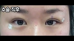 라리두잇 - Youtube