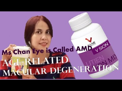 Ms Chan eye cancel is called AMD - Age-related Macular Degeneration