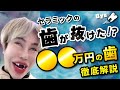 アレン様に直撃！セラミックの価格、痛みは？