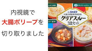 大腸ポリープの内視鏡手術