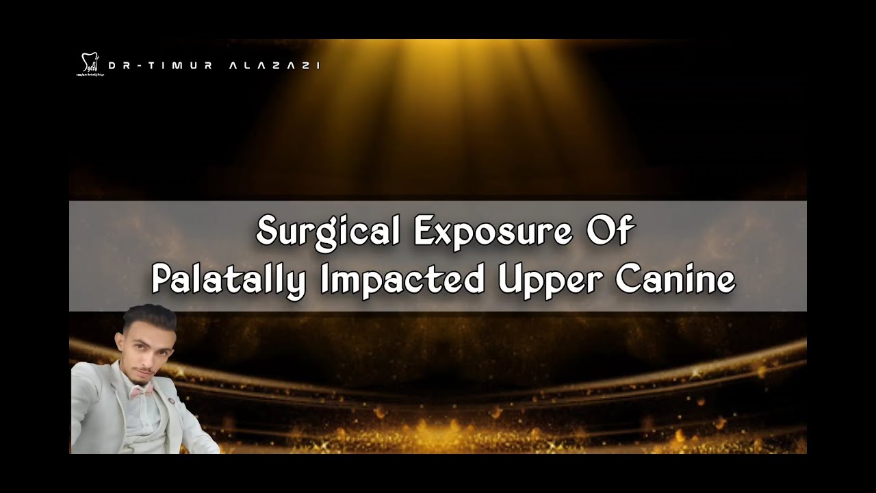 Surgical Exposure Of Palatally Impacted Upper Canine For Orthodontic