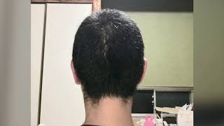 坊主から髪を伸ばす一ヶ月毎の記録・後ろ髪篇（2年間）