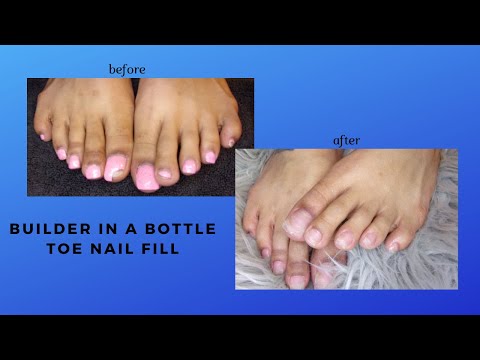 Gel FX Toe Nail Fill