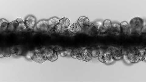Supplementary Movie 4: Matrix softening promotes intestinal crypt morphogenesis