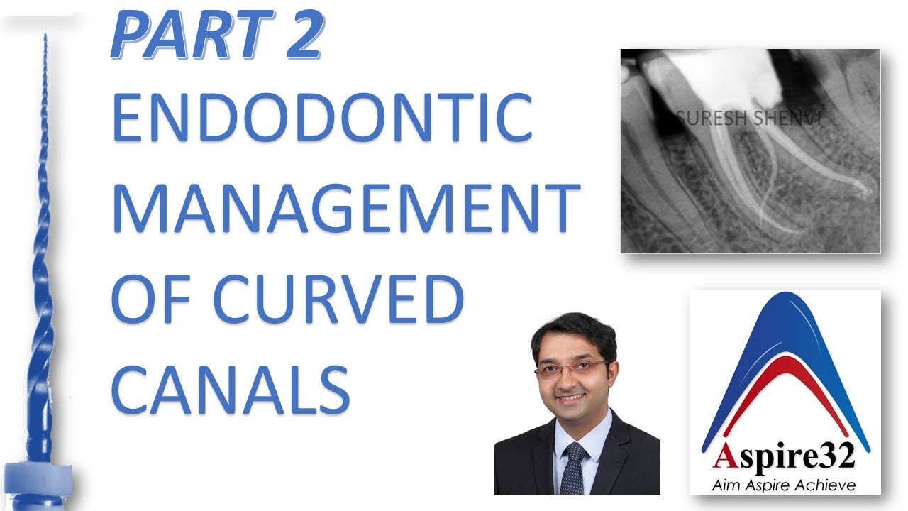 Endodontic Management of Curved Canals - Part 2