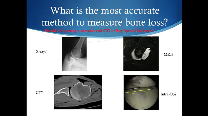 Preoperative Evaluation of Bone Loss in the Unstab...