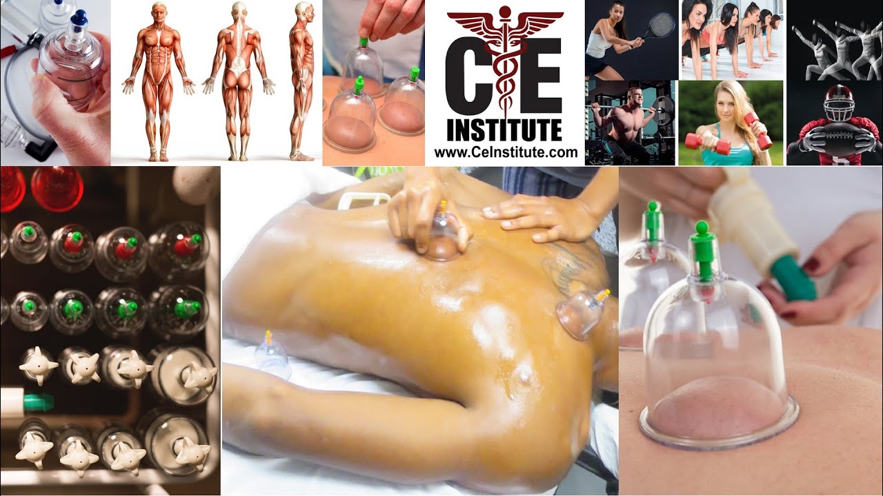Massage Instructor Lecture: The Top 10 Points of Orthopedic Cupping as seen in Massage Magazine