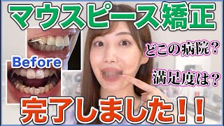 【1年7ヶ月】インビザライン矯正が終了しました！！！