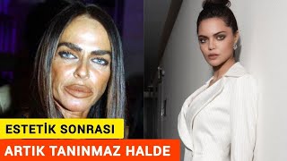 Estetik Sonrası Tanınmaz Hale Gelen Ünlüler