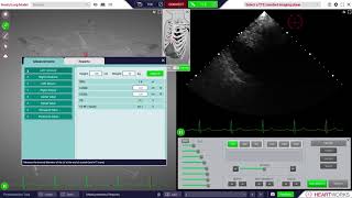 HeartWorks Measurements and Calculations screenshot 1