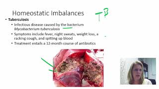 diseases caused by homeostatic imbalance