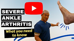 What you need to know about severe ankle arthritis