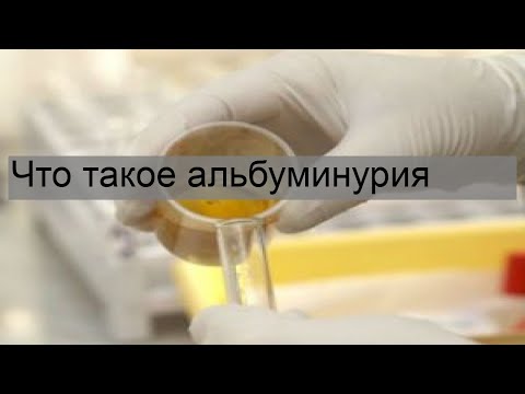 Video: 3 Möglichkeiten, Gelbsucht zu behandeln