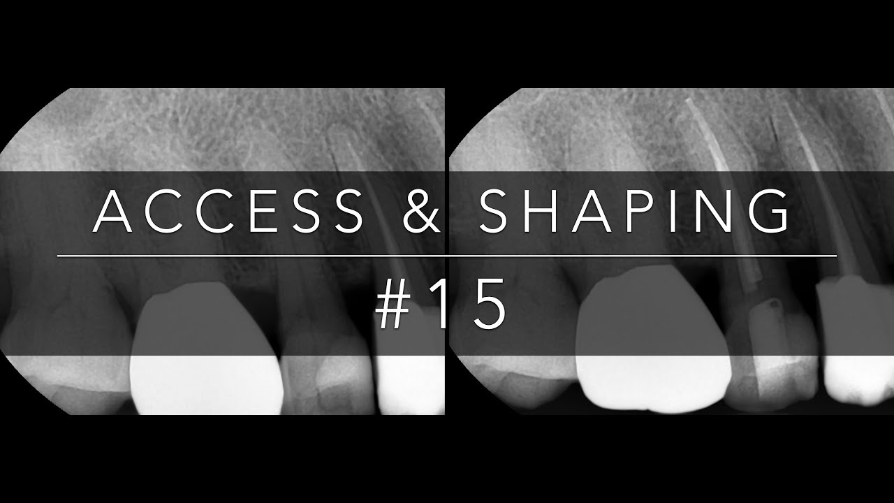 #15 Access & Shaping - YouTube