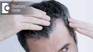 Can I use hair oil after applying minoxidil?- Dr. Rasya Dixit