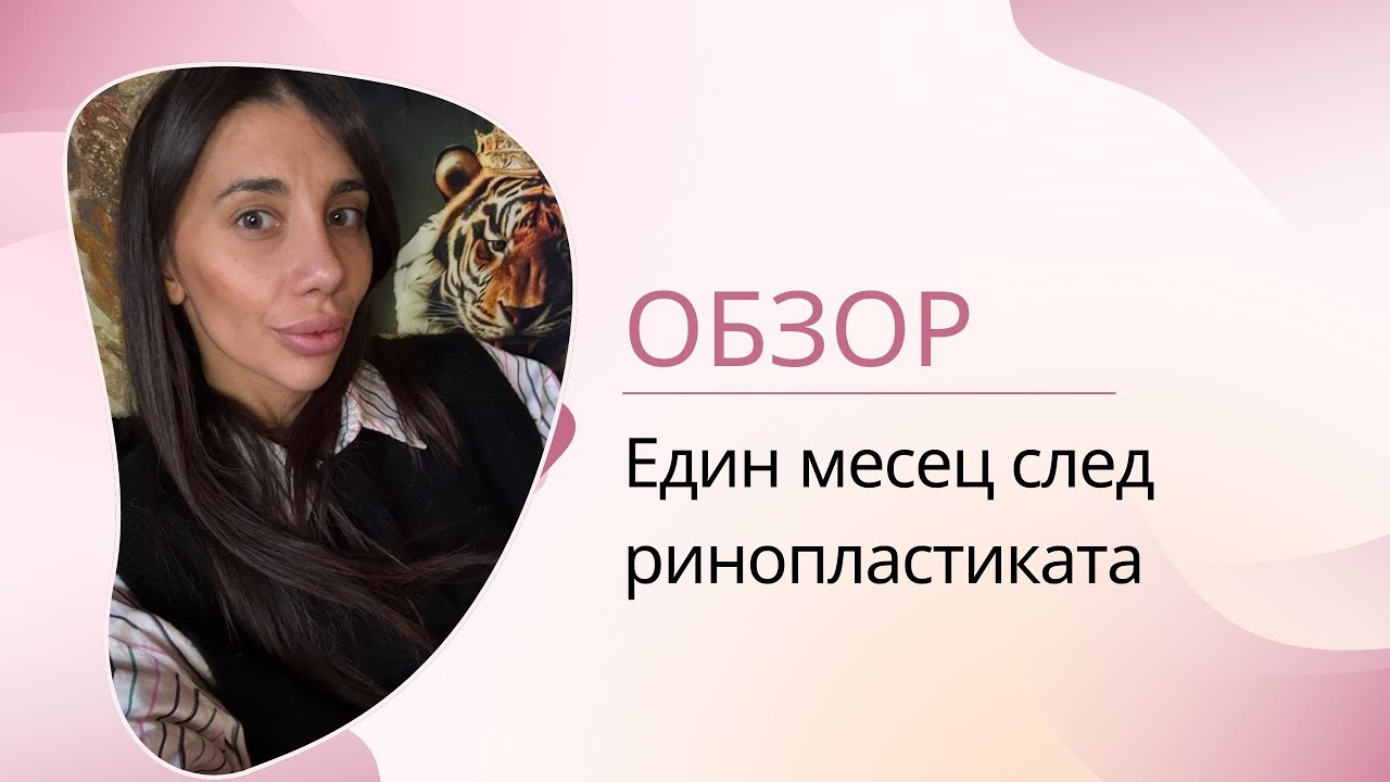 Обзор - Един месец след ринопластиката
