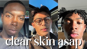 how to get clear skin for guys asap (no bs)