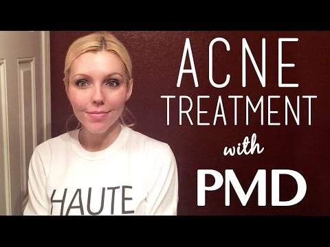 PMD Personal Microderm Review for Acne & Acne Scars Treatment