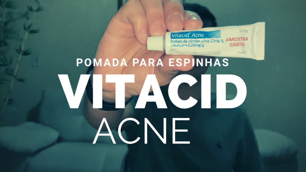 VITACID ACNE - A MELHOR POMADA PARA ESPINHAS DO MERCADO - YouTube