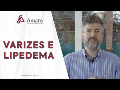 Varizes e Lipedema