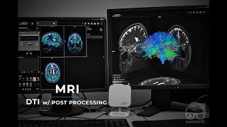 MRI – DTI w/ post processing