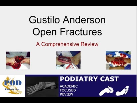 Trauma  - Gustilo Anderson Open Fracture Classification - POD