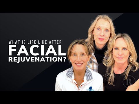 What is Life Like After Facial Rejuvenation?