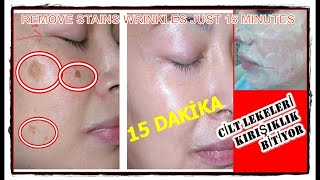 15 MINUTES LATER YOU WON'T  BELIEVE IN EYES %100 EFFECTIVE MASK #SkinFirming #SkinWhitening #Scars screenshot 1