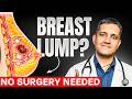 Breast Fibroadenoma Treatment Without Surgery | Scarless Breast Lump Removal Treatment
