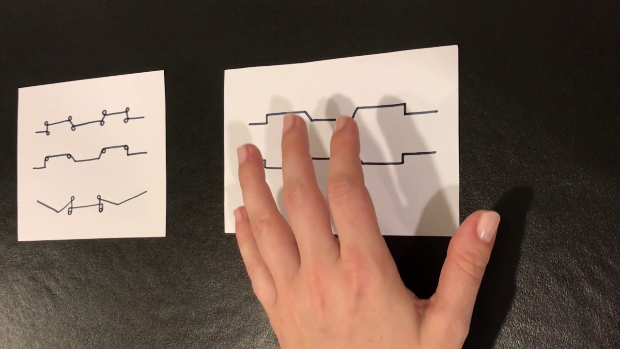 Arco UTILITARIO, contracción, avance y RIT (Ortodoncia)
