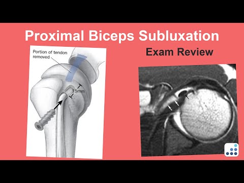 Proximal Biceps Subluxation Exam Review - Jay Keener, MD