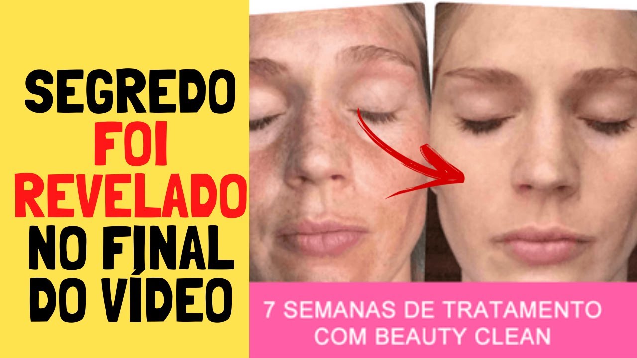BEAUTY CLEAN - BEAUTY CLEAN Funciona Mesmo ? BEAUTY CLEAN Clareia as MANCHAS DA PELE? Onde COMPRAR?