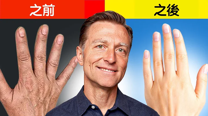 手干,手皱,第一名天然护肤法,柏格医生 Dr Berg - 天天要闻