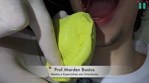 Como é feita a moldagem de transferência?