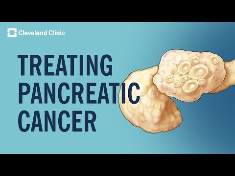 Treating Pancreatic Cancer