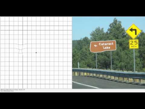Amd App4eyes