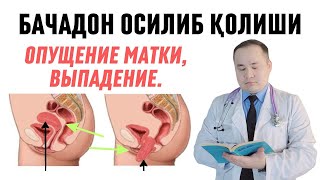 АЁЛ МАТКАСИ ТУШИШИ ОПУЩЕНИЕ МАТКИ САБАБЛАРИ, БЕЛГИЛАРИ, АЁЛЛАР МАТКАМ ТУШМАСИН ДЕСАНГИЗ КЎРИБ ҚЎЙИНГ