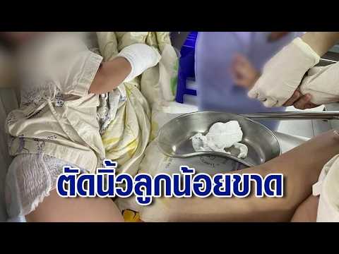 Family in Tears: Nursing Assistant Cuts Off 1-Year-Old's Finger While Removing IV, Reattachment F...