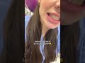 PZR Shorts Dentist Zfa Zahnarzt Viral Fyp Youtubeshorts Funny Mygirl Balkan Russia