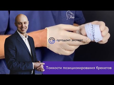 Подвальников Максим Сергеевич / "О тонкостях позиционирования брекетов"