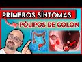 ESTOS son los 7 PRIMEROS SINTOMAS de PÓLIPOS de COLON || ¡NO los IGNORES!