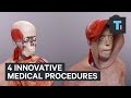 4 innovative medical procedures