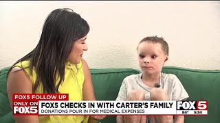 Donations pour in for Las Vegas boy with severe skin condition