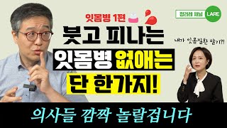 치과 가도 소용없습니다. 잇몸병 없애는 가장 확실한 방법! [정라레]