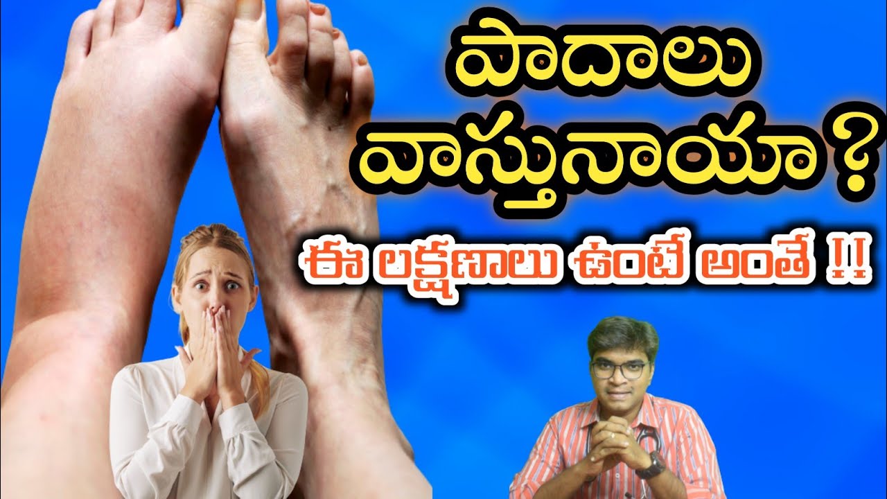 Swelling Of Foot Causes And Treatment Foot Swelling Homeopathy medicine
