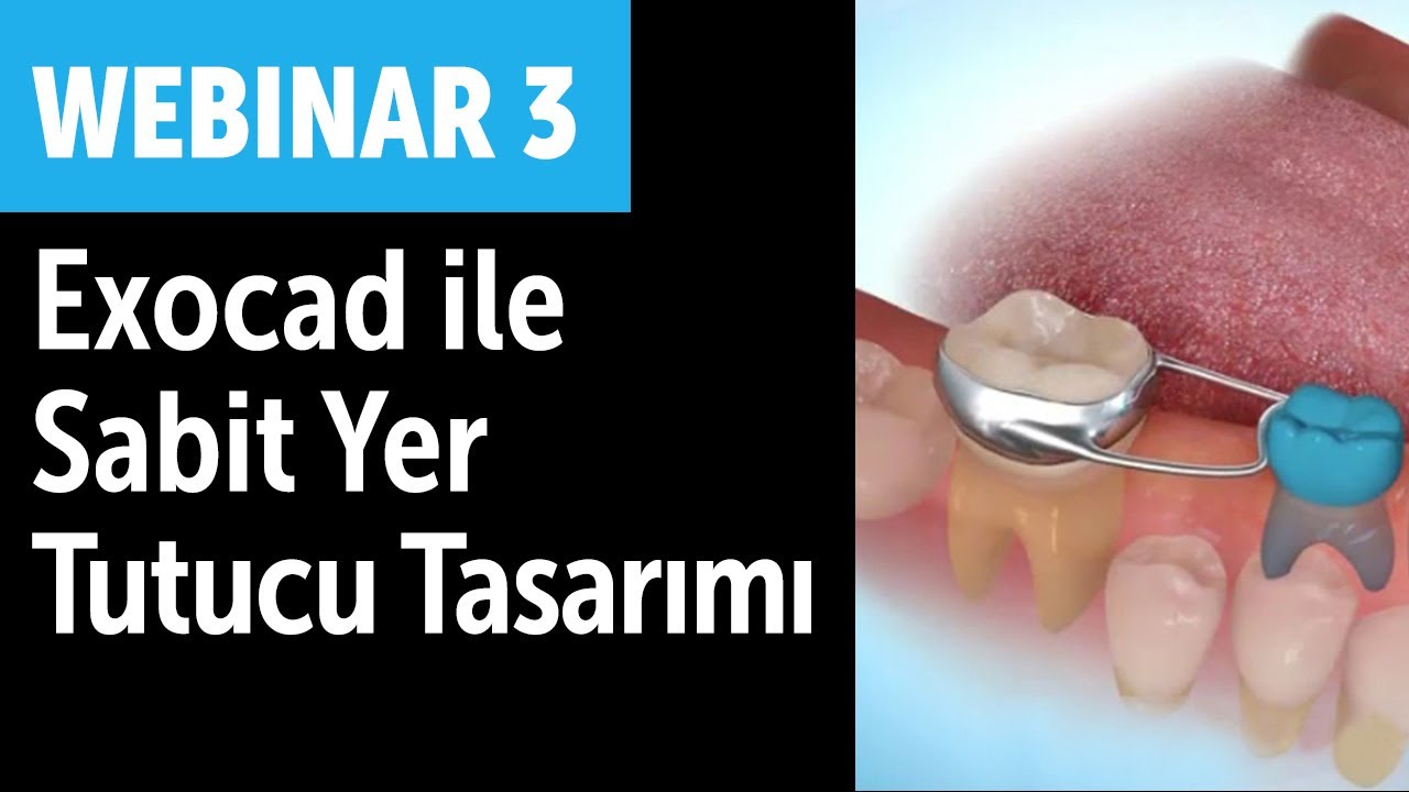 Webinar 3: Exocad ile Sabit Yer Tutucu tasarımı nasıl yapılır?