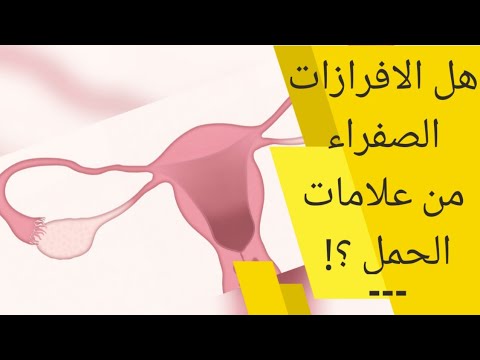 فيديو: هل الإفرازات البيضاء المصفرة علامة على الحمل؟