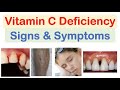 Vitamin C Deficiency Signs &amp; Symptoms, Consequences (&amp; Why They Occur)