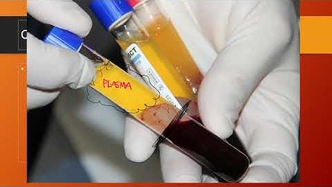 CTC 210 Forensic Chemistry:  Blood Basics:  Components Part 1
