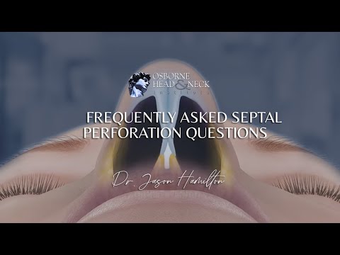 Septal Perforation: Frequently Asked Questions by Dr. Jason S. Hamilton